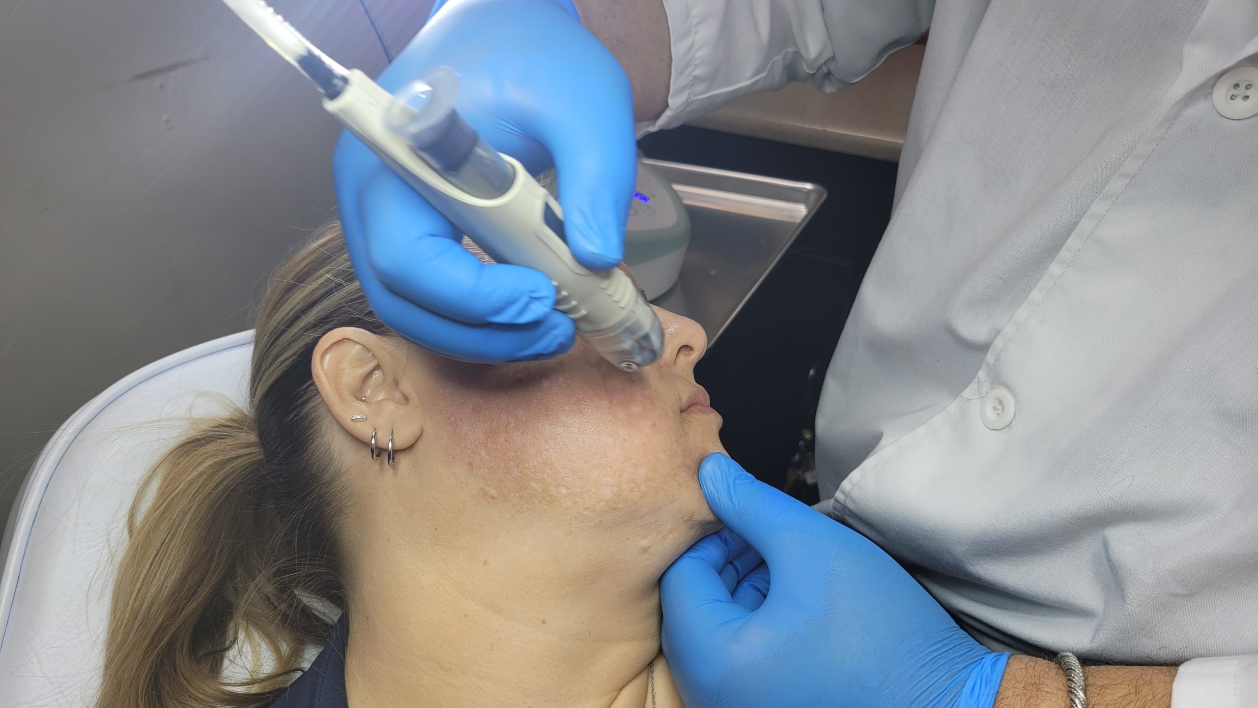 Facial treatment at PV MediSpa